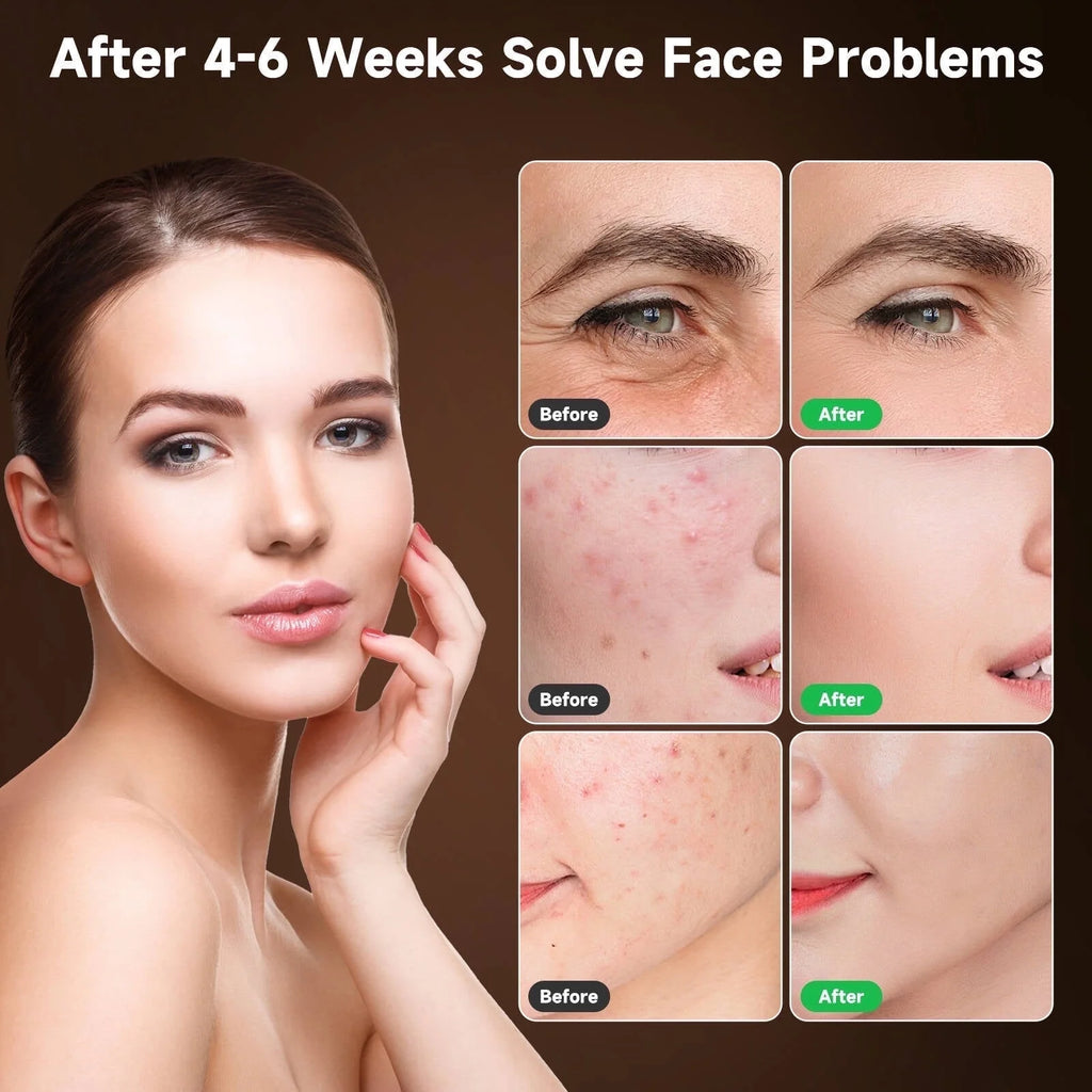 Red Light Therapy for Face, 4 Modes Led Face Mask Light Therapy with Remote, Portable Light Therapy Mask for Skin Care at Home, Travel (Black)